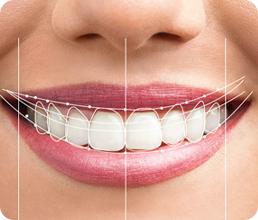 Çene Eklemi TME Tedavisi